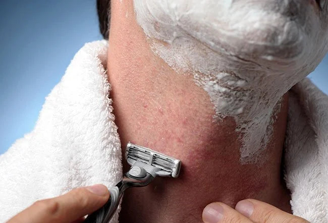 How to Get Rid of Razor Bumps and Ingrown Hair Naturally
